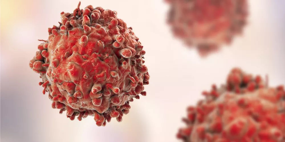 هل يمكن لأدوية السكري والضغط أن تساهم في قتل الخلايا السرطانية؟