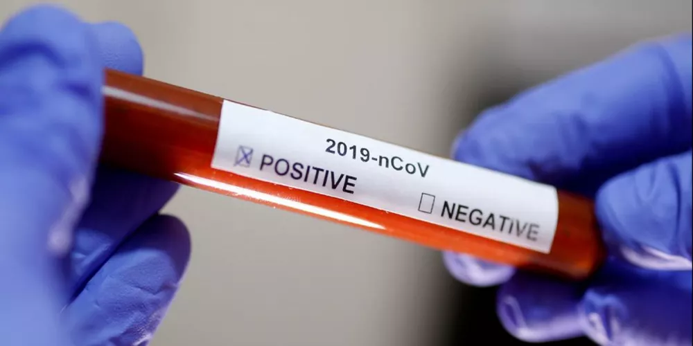 مدى دقة فحص فيروس كورونا (كوفيد-19)