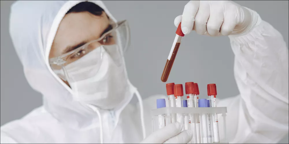 نوع فصيلة الدم قد يحدد خطر الإصابة بفيروس كورونا