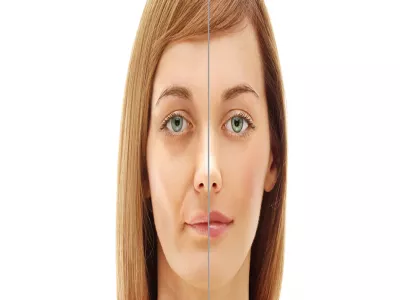 اجتناب الهواء البارد