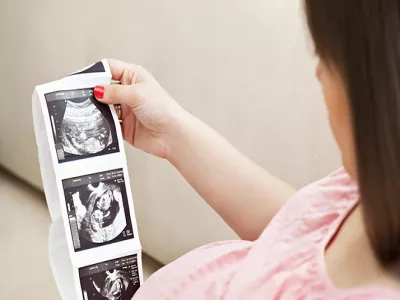 فحص الامواج فوق الصوتية السونار خلال الحمل
