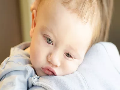 اعراض بزوغ الاسنان لدى الاطفال