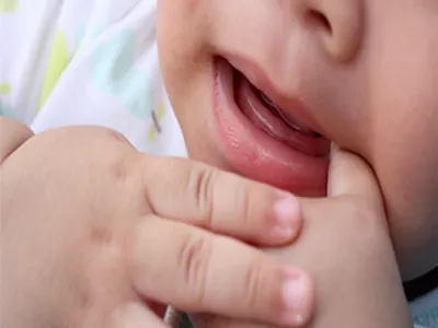 متى ينبغي ان تاخذي طفلك الى طبيب الاسنان لاول فحص طبي