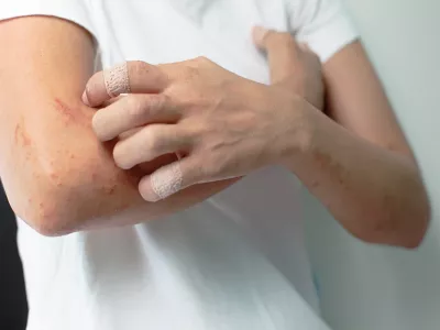 الأدوية المستعملة في الأمراض الجلدية