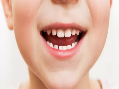 حليب الأم واثره على نمو الأسنان
