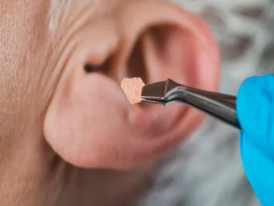 علاج انسداد الأذن