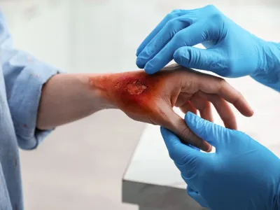 6. اعرف علامات العدوى