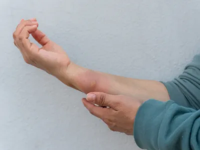 2. أزل أي ملابس أو إكسسوارات محيطة بالحرق