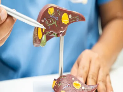 أعراض فشل الكبد