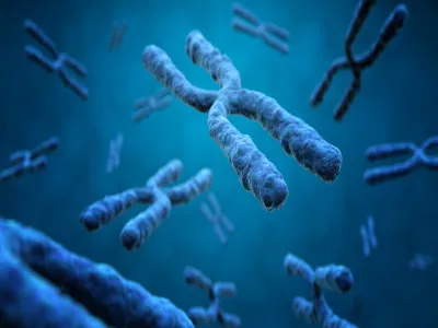 متلازمة كلاينفلتر (XXY): الأسباب والأعراض والعلاج بالصور