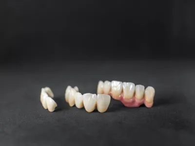 نصائح للعناية بتركيبات الأسنان