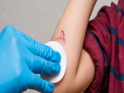 الوقاية من تسمم الدم