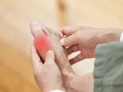 أعراض القدم السكرية