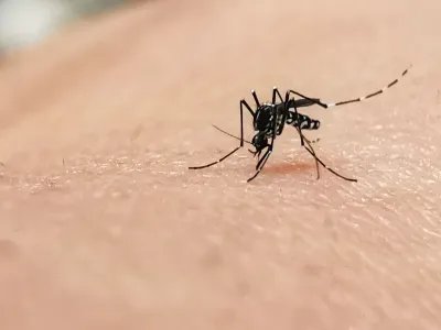 شكل حبة اللشمانيا بالصور: كيف تبدو؟ ومتى تكون خطيرة؟