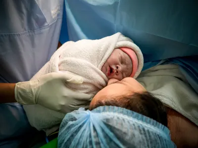 العملية القيصرية بالصور: دواعي الإجراء، المخاطر، والتعافي