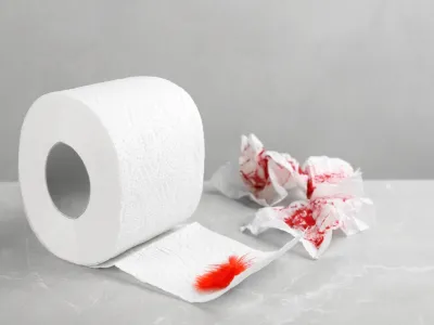 أعراض البواسير