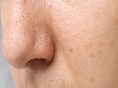 1. الرؤوس البيضاء والسوداء