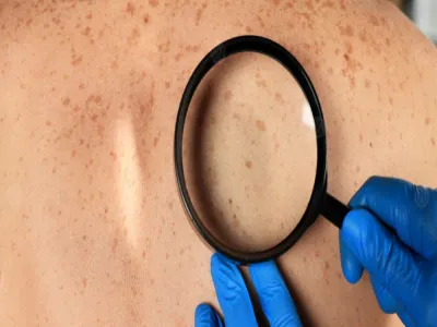 تصبغات الجسم