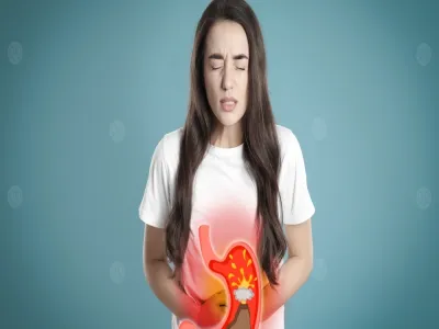 علاج الحموضة أثناء الصيام