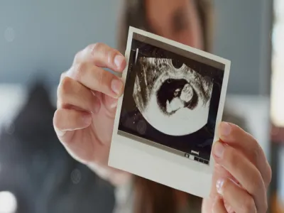 تقنية تكشف جنس الجنين بعد 3 أيام