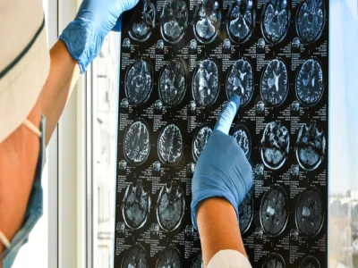 سائل مغناطيسي في القلب قد يمنع السكتة الدماغية