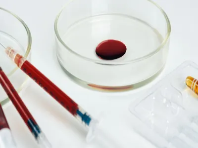 جزيء من دم الأفاعي قد يعالج السمنة