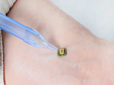 شريحة تحت الجلد تنتج الدواء داخل الجسم