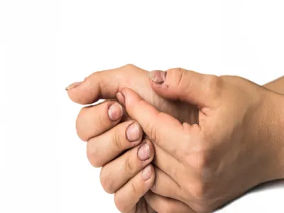 ما سبب سواد الجلد حول الأظافر