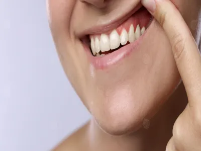 فوائد الصيام واللثة