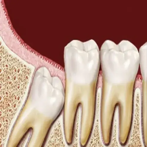 د. هيثم الكايد اخصائي في طب اسنان