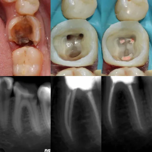 د. فاطمة محمود اخصائي في طب اسنان