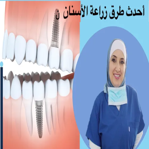 تيفاني سمايل اند كو اخصائي في طب اسنان