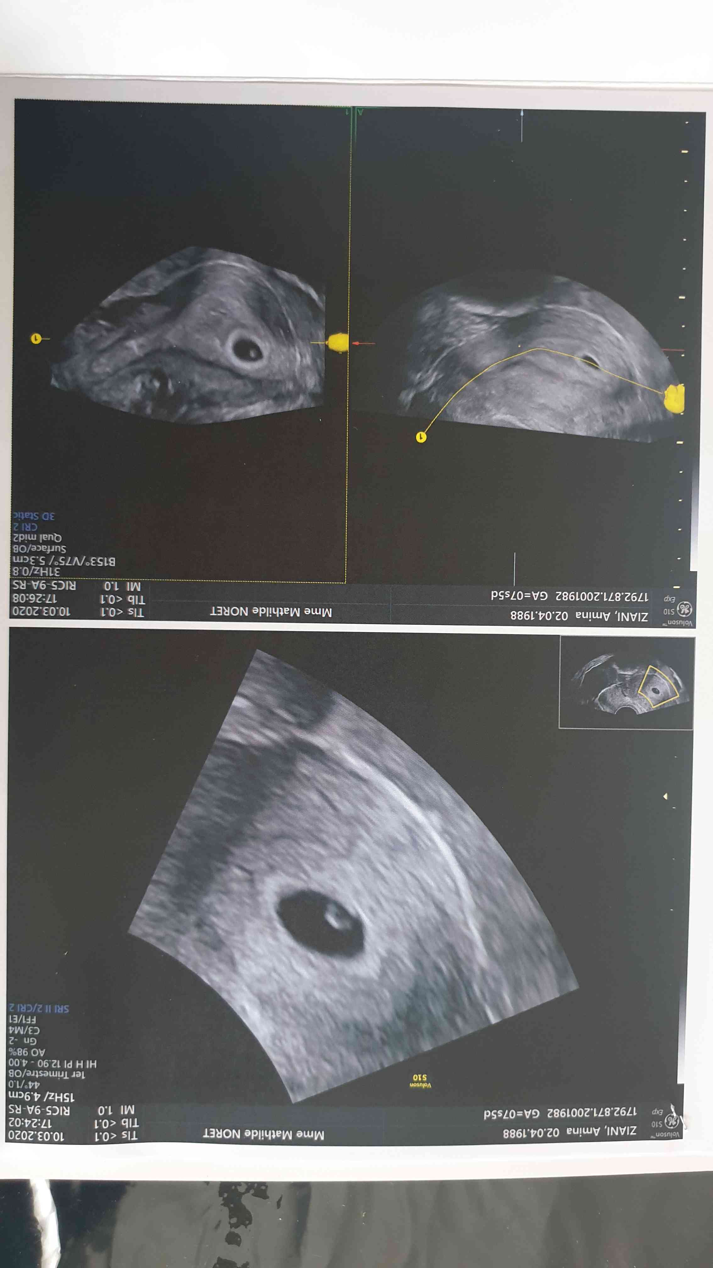 71dddc23-df95-41ab-9cd1-eca5ac87241d