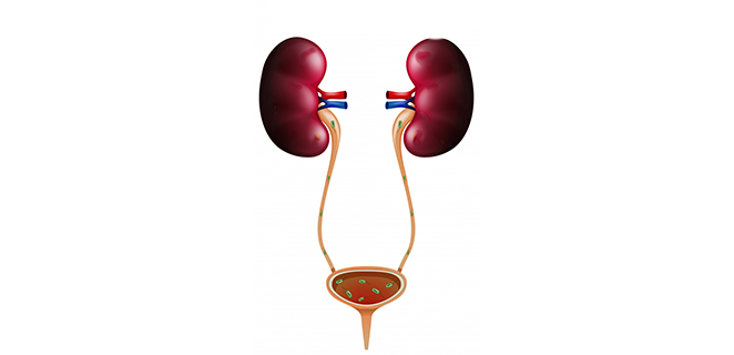 انسداد المسالك البولية
