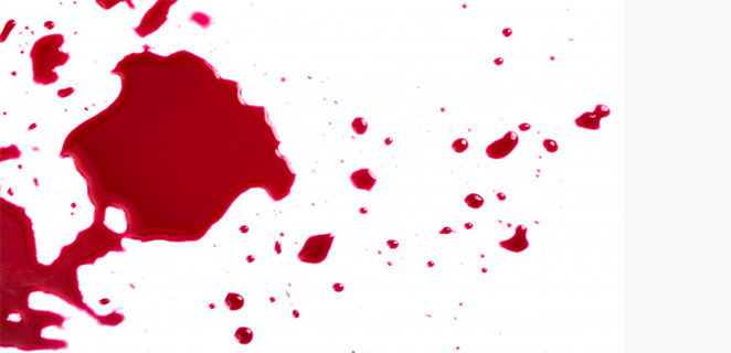 نزيف بعد الممارسة الجنسية