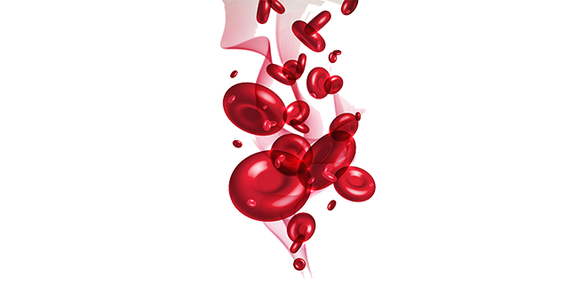 نقص البومين الدم