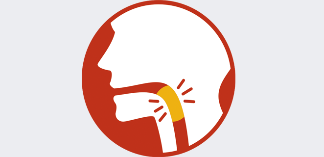 تشنج البلعوم