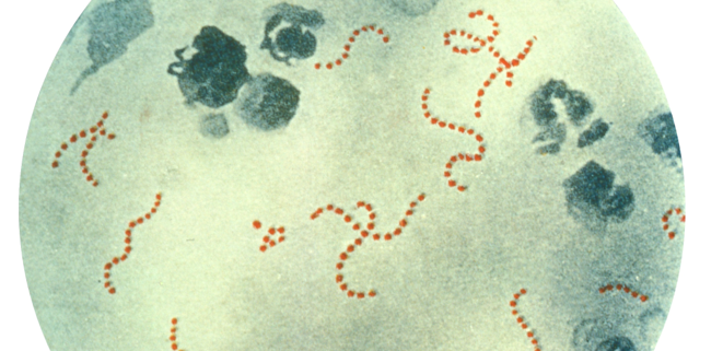 عقدية مقيحة