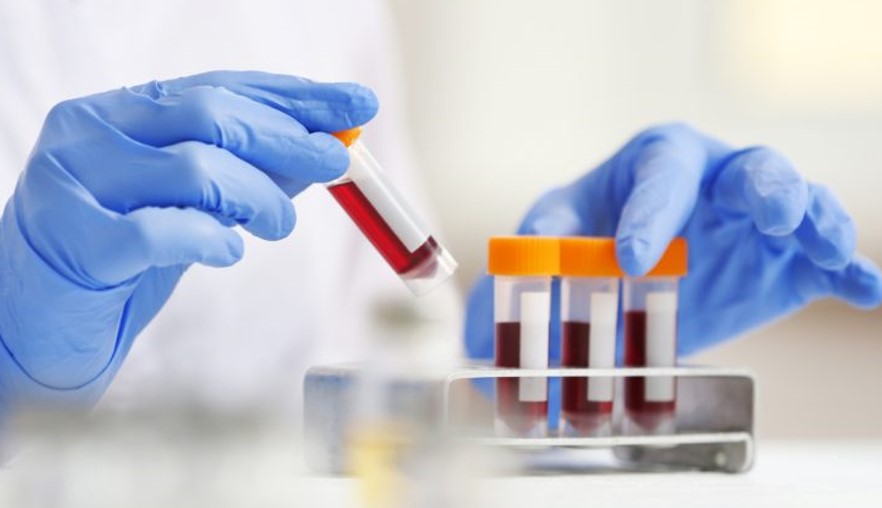 علامات الالتهاب