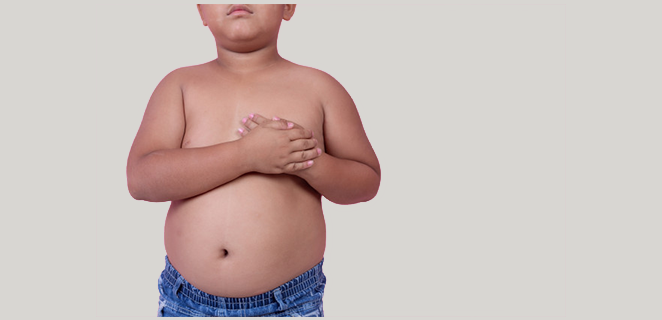 سمنة الاطفال