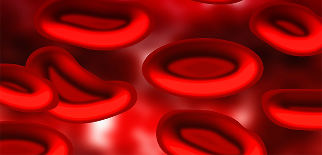 وجود الميتهيموغلوبين في الدم ميتهيموغلوبينية الدم