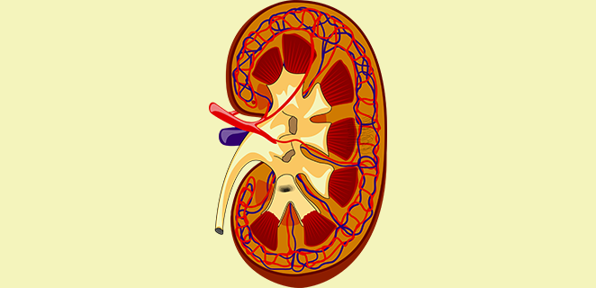 متلازمة فانكوني