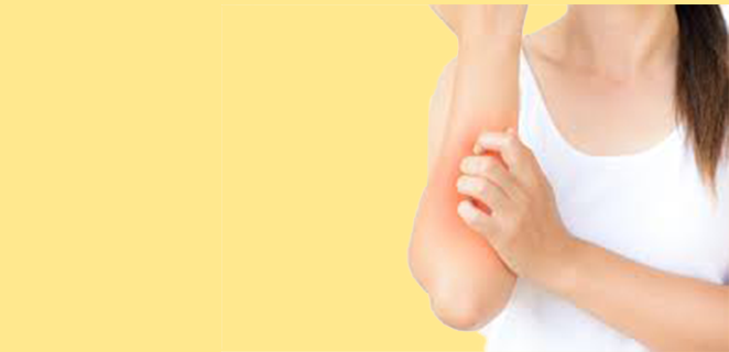 لسعات الجلد