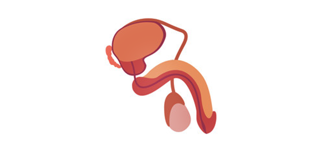 التهاب الحويصلة