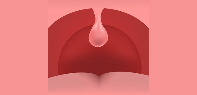 تدلي اللهاة