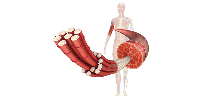 الضمور العضلي التوتري