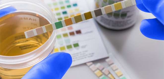 تركيب البول