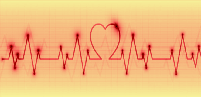 تسرع القلب البطيني Ventricular Tachycardia اسباب اعراض الطبي