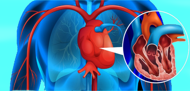 التهاب الابهر