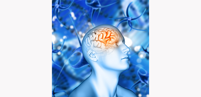 اضطراب الدماغ الحاد